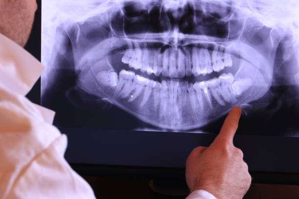 Best Tooth Infection Emergency Dentist  in Fussels Corner, FL