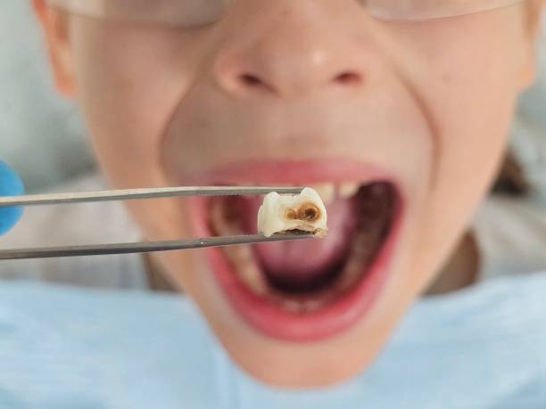 Best Teeth Whitening  in Fussels Corner, FL